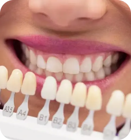 Cosmetic Dentistry