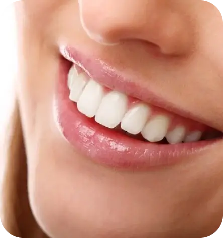 teethteplacement